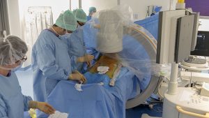 vidéo anévrisme abdominal en ambulatoire